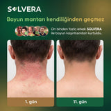 Solvera | Yoğun Arındırıcı Mantar Karşıtı Sabun Bar