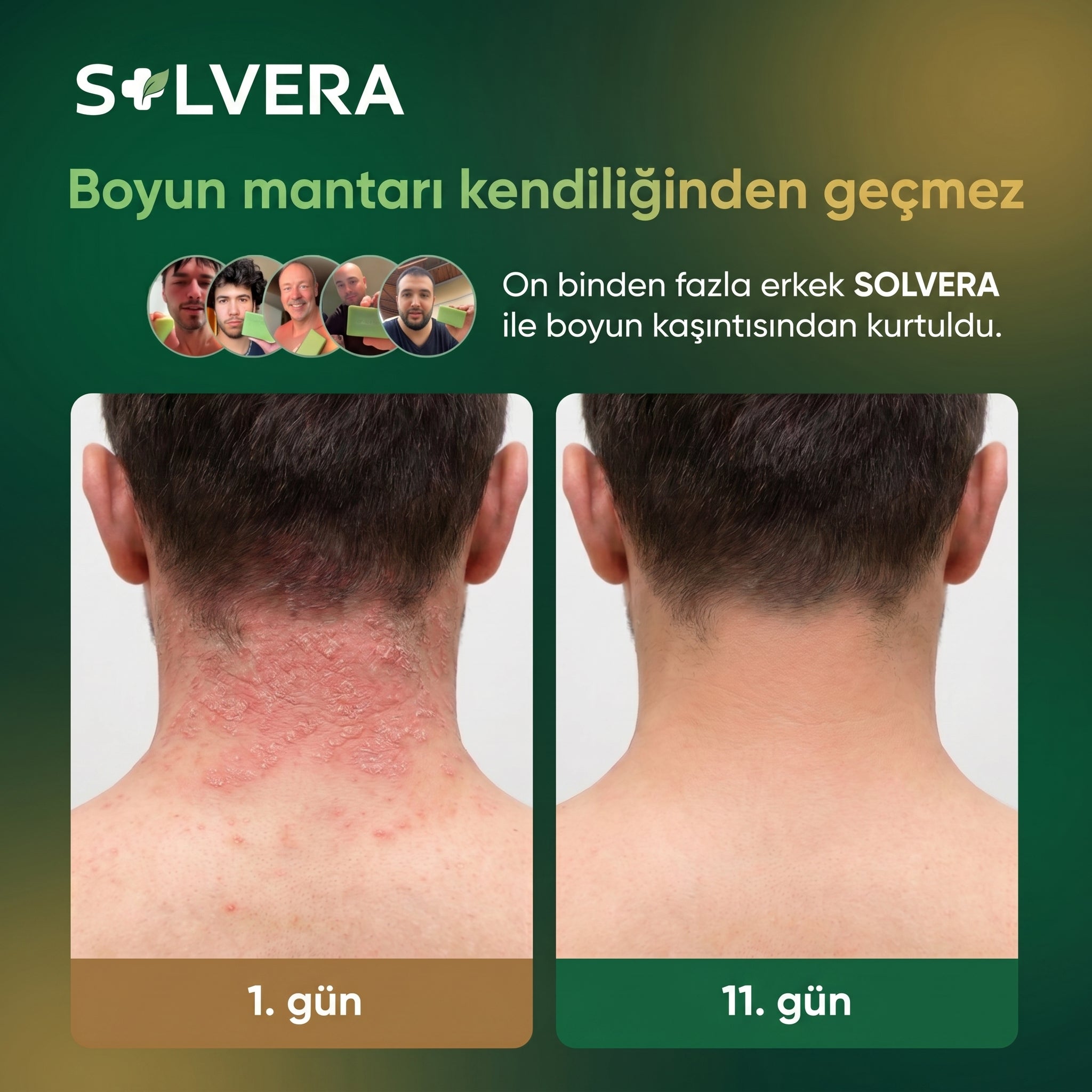 Solvera | Yoğun Arındırıcı Mantar Karşıtı Sabun Bar