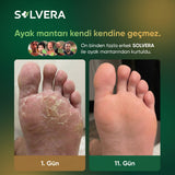 Solvera | Yoğun Arındırıcı Mantar Karşıtı Sabun Bar